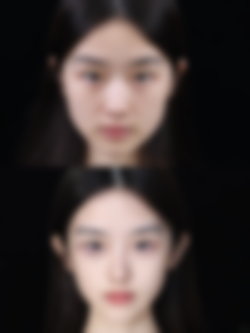 三亚爱丽丝医疗美容口碑如何？