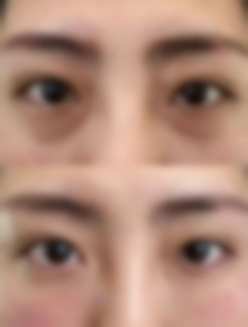 正畸治疗在矫正中的作用