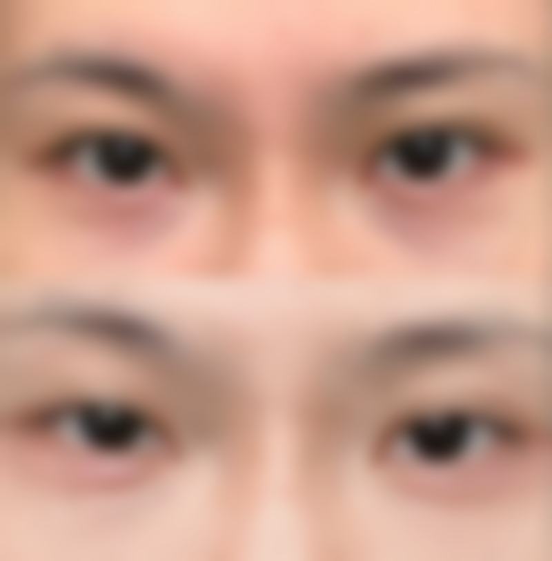 宁波雅韩整形美容医院口碑如何?
