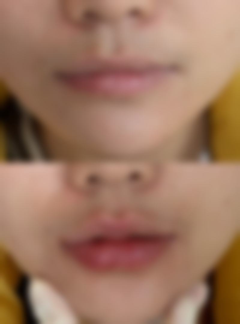 南宁柒和医疗美容门诊部贺劲超医生技术好不好？