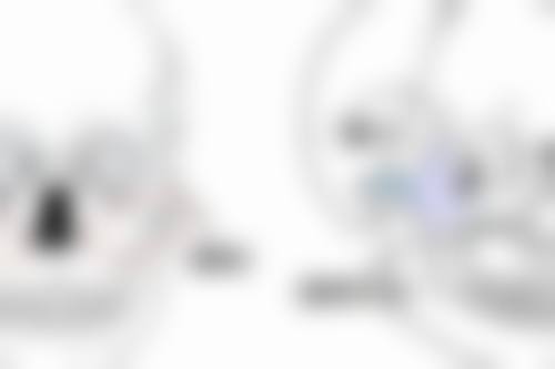 注射隆胸好取出吗？受材料、时长等因素影响，先进方法可助提高取出成功率