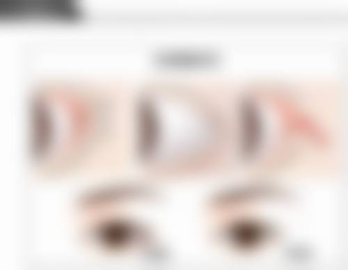 男士去眼袋之日常护理小妙招