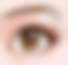 隆鼻的危害有哪些？手术、材料、恢复问题及心理隐患全揭秘