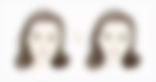 做吸脂手术有什么副作用？麻醉感染栓塞等风险及皮肤问题、身体不适要知晓