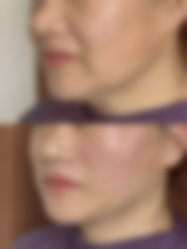 孝感黄清雨时光整形地址