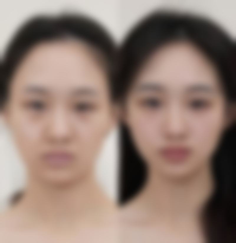 广州形美整形美容医院硬件设备精良！