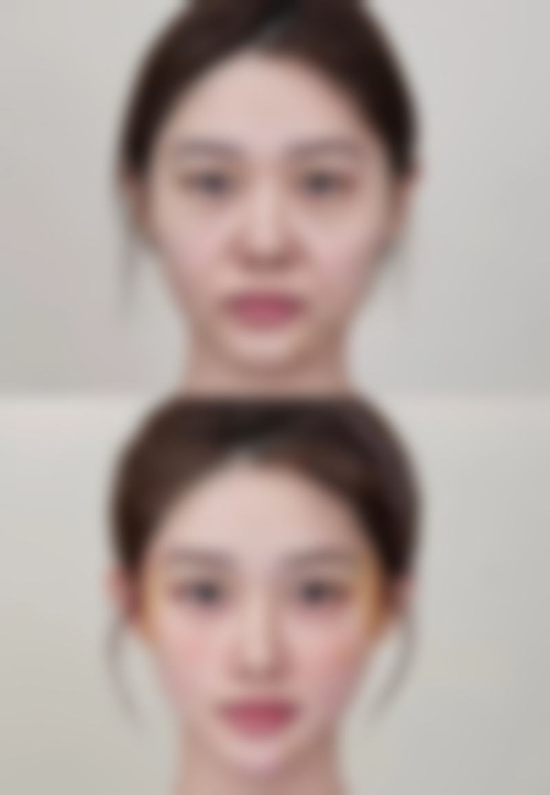 广州形美整形美容医院医院技术好不好？