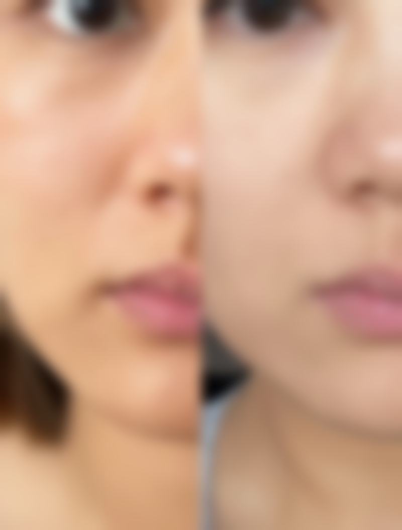 美白针和水光针的作用成效