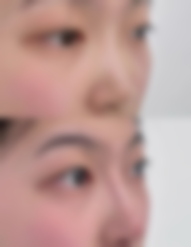 美白针和水光针的成分差异