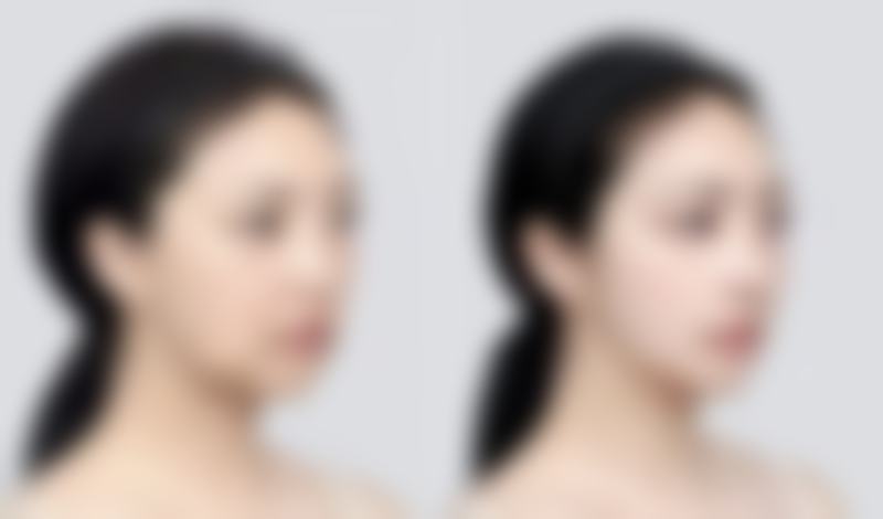 南宁艾美医疗美容门诊部医院技术好不好？