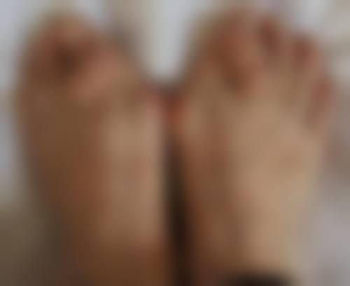 自身免疫性疾病患者不能打美白针