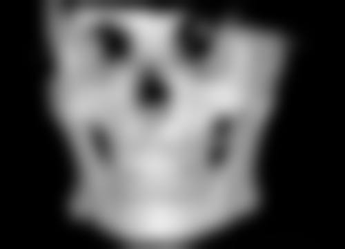 种植头发的常见误区