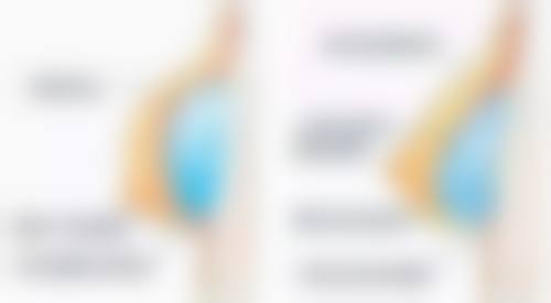 美白针的其他注意事项