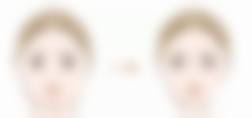 吸脂手术后可能出现的近期危害