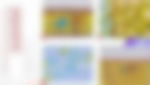 手术缝合方法完成阴道紧缩