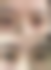 如何降低吸脂手术的危害