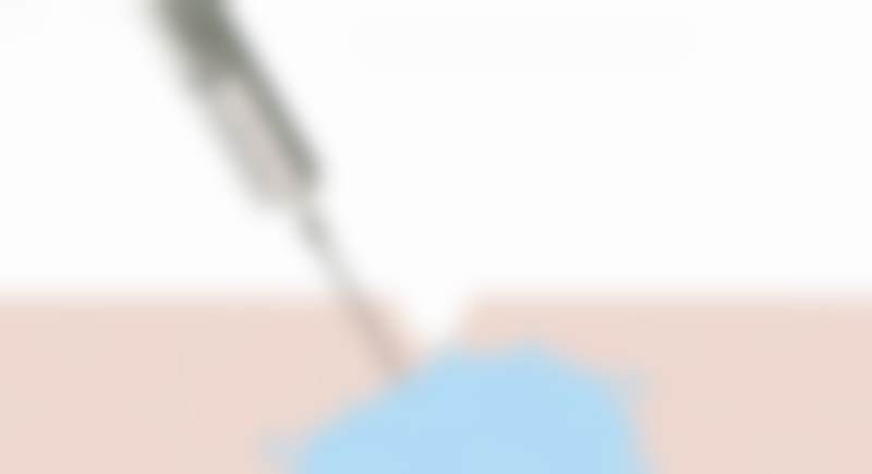 广州高尚医学美容中 心栾翰林医生挂号预约攻略