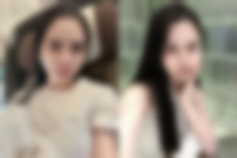 湖州唯美医疗美容门诊部医院技术好不好？