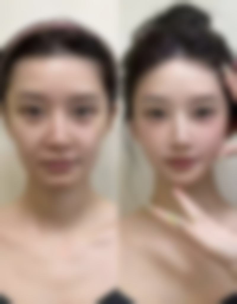 北京自然美人韩国整形医院地址