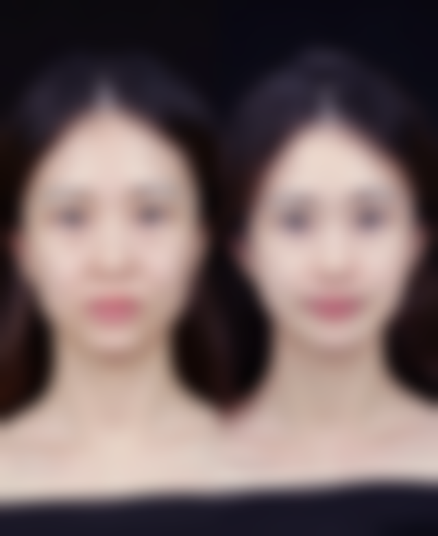 通化吴学军美容整形外科诊所口碑如何？