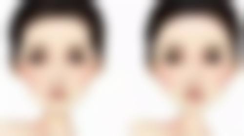 郑州曙光植发医院情况如何?