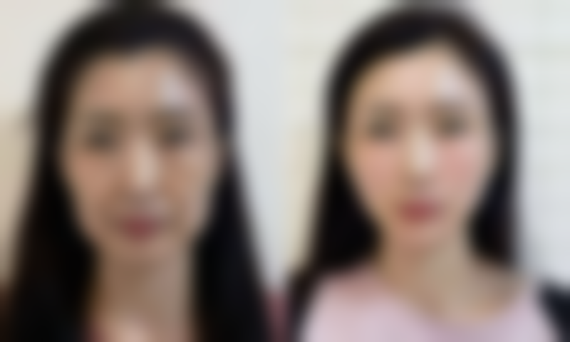 株洲速青春医疗美容诊所医院技术好不好？