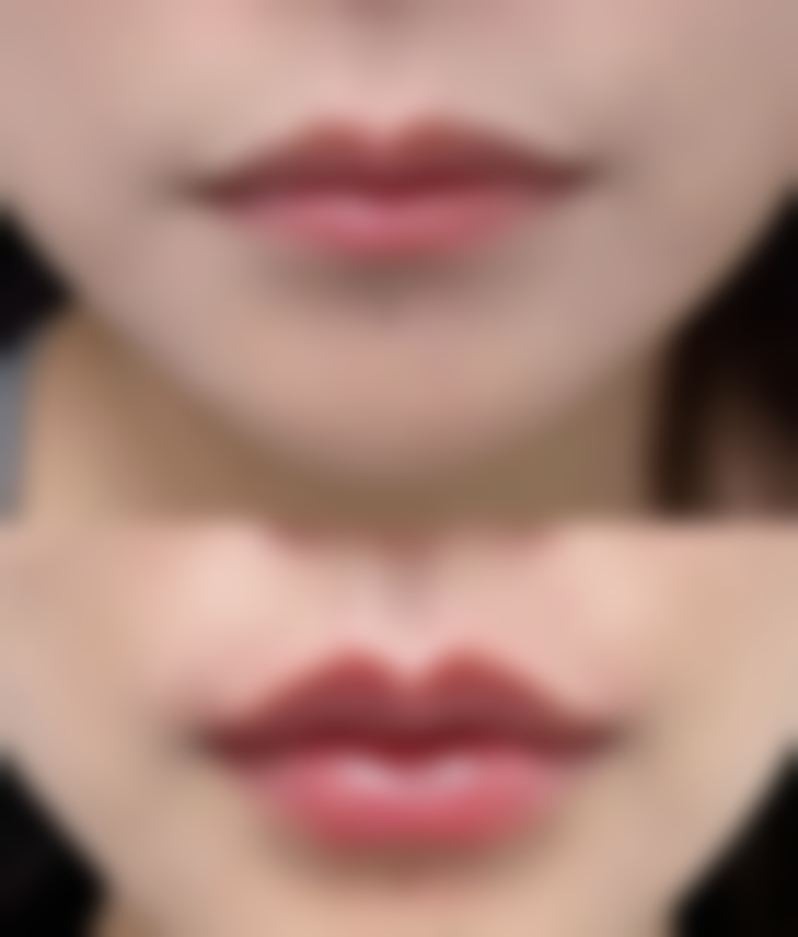 总结——南京熙涵医疗美容怎么样？