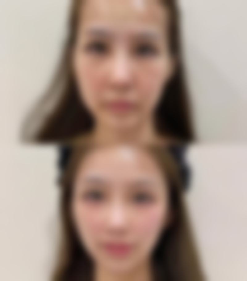 大同初合医疗美容门诊部硬件设备精良！