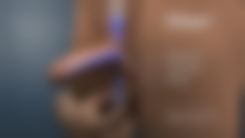 总结——沈阳韩秀宫医疗美容诊所芮春昊医生怎么样?