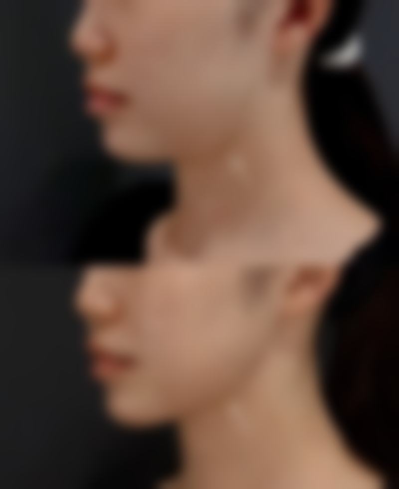 韩国Mega整形外科