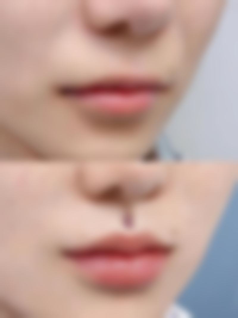 东海县人民医院美容烧伤整形科地址