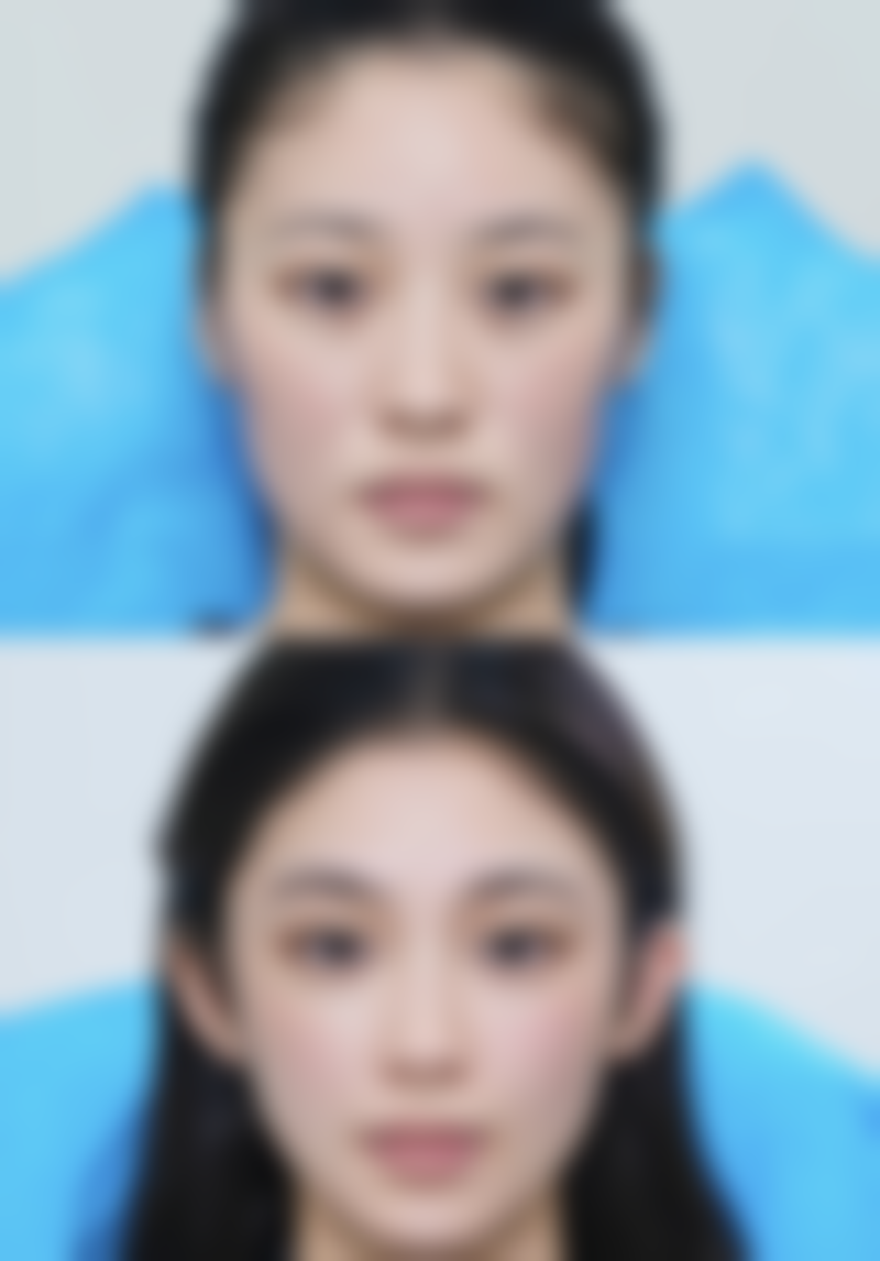 福州鼓楼恩喜整形医院医院技术好不好？