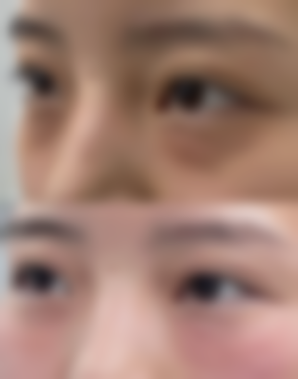 韩国Mega整形外科