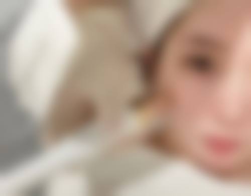 成都高新奕格致美整形医院医院技术好不好？