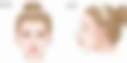 总结——杭州艾尔莎奥拉克医疗美容怎么样？