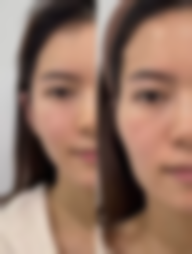 石阡县人民医院收费标准参考