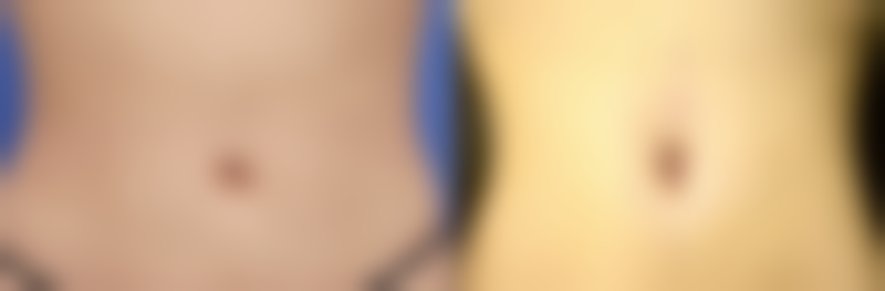 成都高新奕格致美整形医院硬件设备精良！