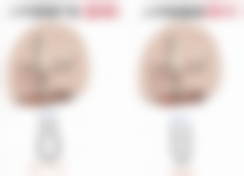 达州爱尔博视医院胡建斌医生技术好不好？