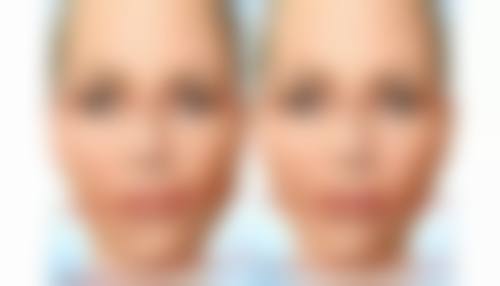 重庆睿美整形医院医院技术好不好？