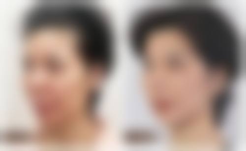 呼和浩特五洲女子医院收费标准参考