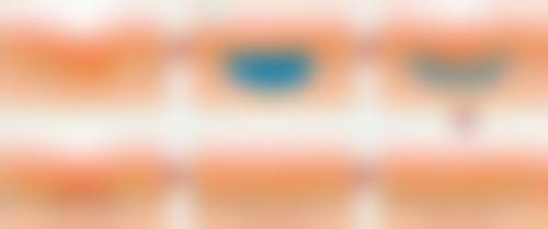 总结——衢州柯城馨丽莱整形医院怎么样？