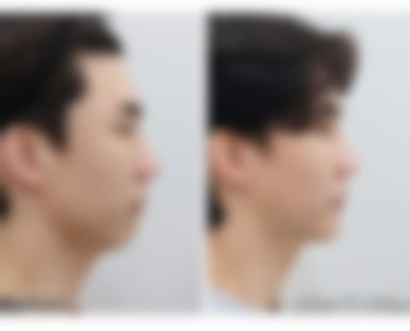 广州美博汇医疗美容门诊部罗科义医生技术好不好?