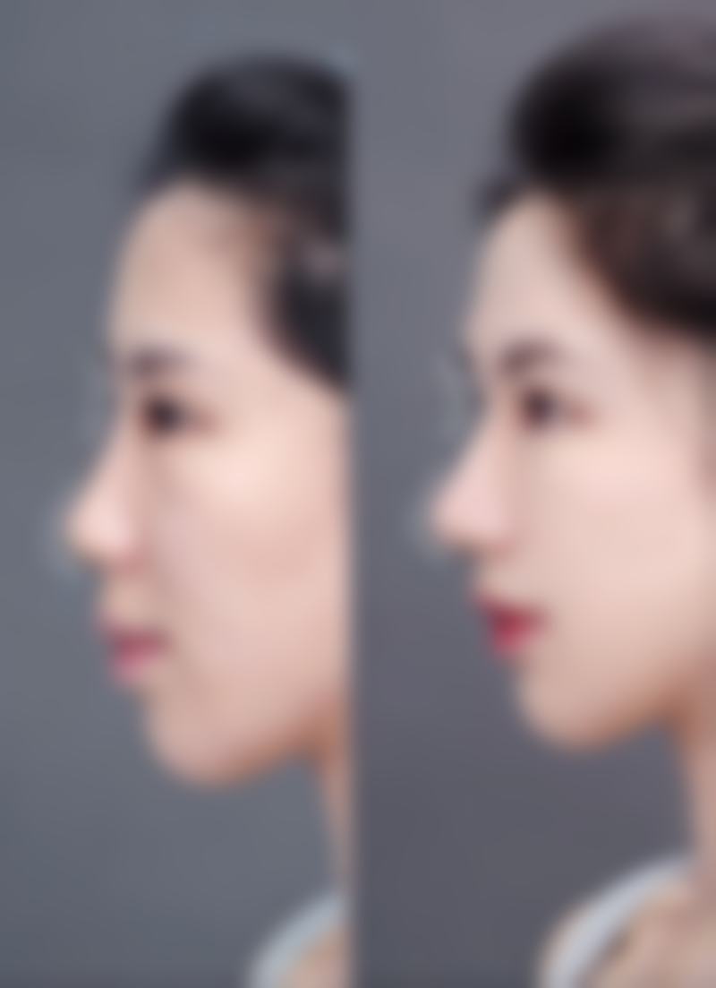 成都安格尼安德医疗美容诊所季明军 医生挂号预约攻略