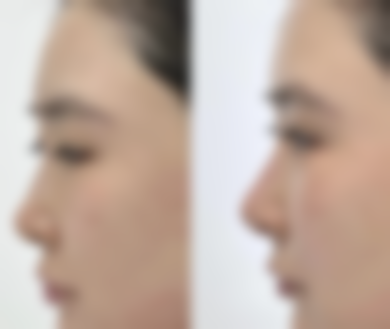 呼和浩特五洲女子医院医院技术好不好？