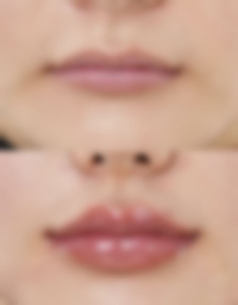 总结——韩国iWell爱我整形外科医院怎么样？