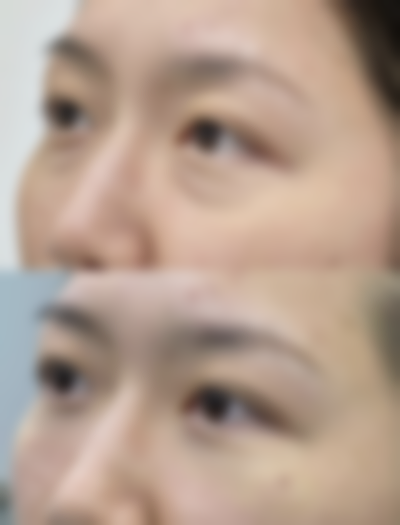 总结——丽水樊承红医疗美容诊所樊承红医生怎么样？