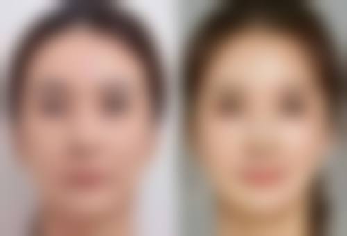 武汉领秀医疗美容门诊部陈琳森医生口碑评价如何？