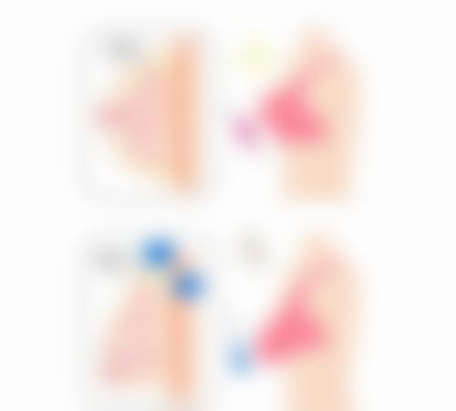 长沙雅美医疗美容医院技术好不好？