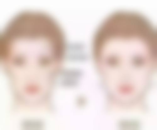 欧佩拉整形医院口碑如何？