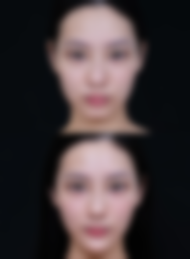 河南元素禾喜医疗美容门诊部收费标准参考